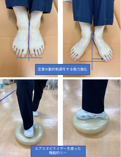 足関節捻挫について｜記事・コラム｜広報・動画コンテンツ｜医療法人